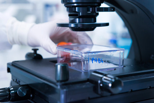 Cancer research laboratory, male scientist studied cells under the microscope