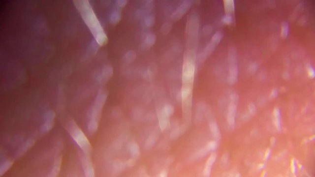 Nose skin under microscope Full HD