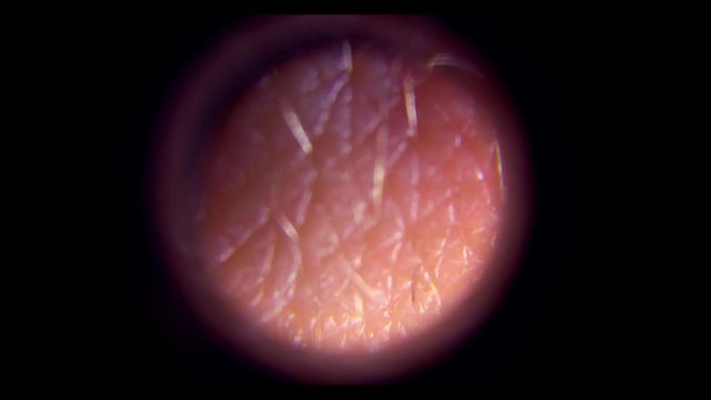 Nose skin under microscope Full HD