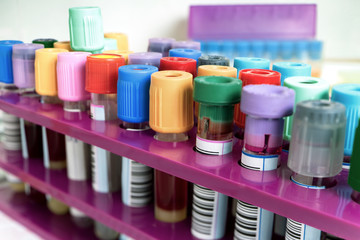 tubes with blood on a tray / blood samples on rack in the lab 