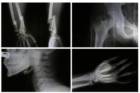 collection of film x-ray