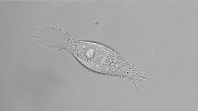 Movement of PC-3 human prostate cancer cell in culture.
