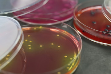 細菌の鑑別イメージ　黄色ブドウ球菌