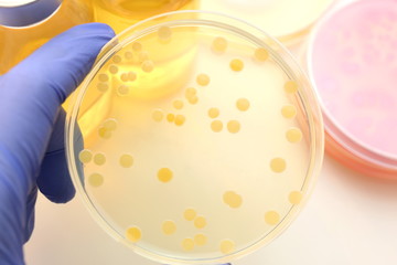 研究イメージ　細菌の鑑別
