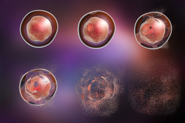 Cell lysis. 3D illustration. Series of images showing different stages of destruction of a cell. Can be used to illustrate effect of drugs, medicines, microbes, nanoparticles, apoptosis