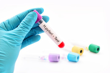 Test tube with blood sample for H.pylori bacteria test
