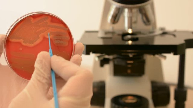 Laboratory doctor hands with sterile gloves using inoculation loop to isolate streptococcus bacteria from blood agar infected this bacteria. Medical laboratory concept