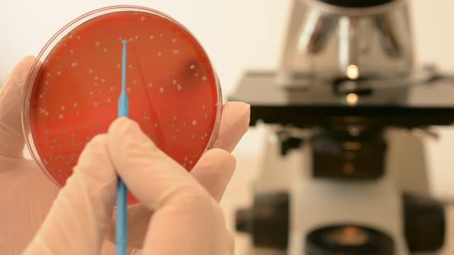 
00:02 | 00:11
1&times;

Scientist's hand checking petri dish and pointing streptococcus bacteria with inoculation loop