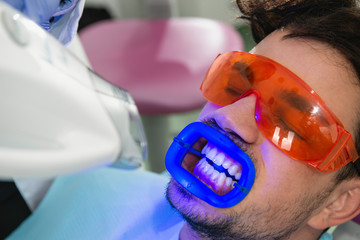 Teeth whitening. Procedure with high powered lamp