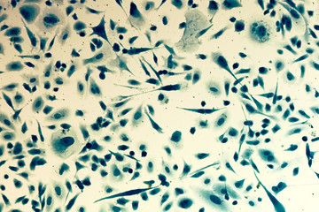 PC-3 human prostate cancer cells