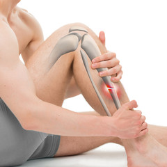 Transverse Fracture of the Tibia - Leg Fracture 3D illustration - obrazy, fototapety, plakaty