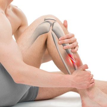 Oblique Fracture of the Tibia - Leg Fracture 3D illustration