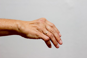 Fototapeta premium Rheuma