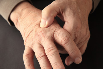 Joint pain on hand of older ma