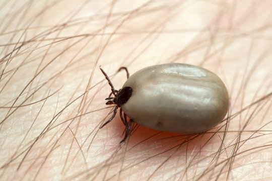 Castor bean tick, Ixodes ricinus, carrier of diseases like tbe and borreliosis filled with blood crawling on human skin