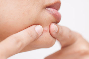 Obraz premium Woman, squeezing pimples, facial.