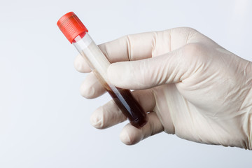 Blutprobe nach Blutentnahme