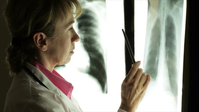 A mature woman doctor looking at an x-ray displayed on an illuminator panel in a dark room.