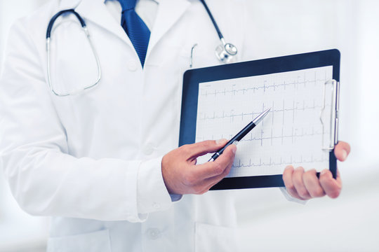 male doctor hands holding cardiogram