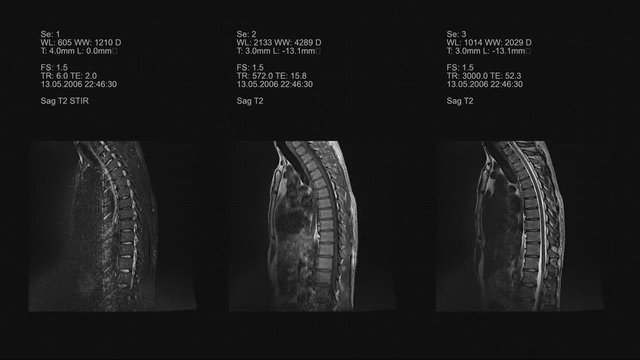 Tomography, Imaging Of The Spine. Picture. 4k medical inerface background