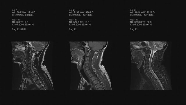 4k set of three neck views of MRI scan. Loopable. Black and White. Medical exam. Magnetic resonance imaging.