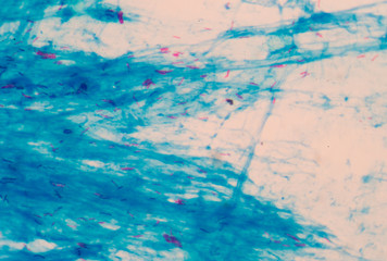 Fototapeta na wymiar mycobacterium tuberculosis red cells on blue background.