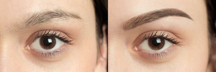 Perfect Eyebrows Before After Two photos - 111779390