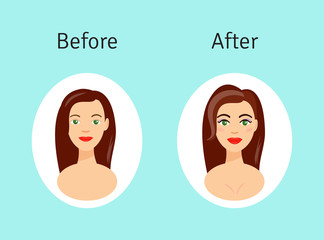 Plastic surgery before and after vector illustration. Portrait of beautiful girl in cartoon style.