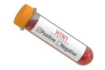 Test tube with blood sample positive with H1N1 virus, 3D renderi