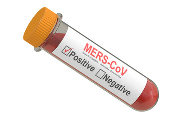 Test tube with blood sample positive with Mers cov virus, 3D ren