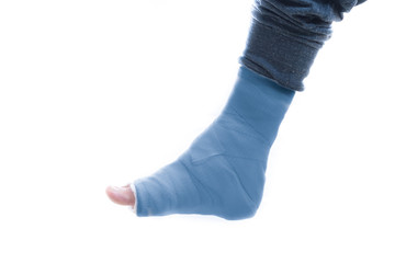 Blue leg cast