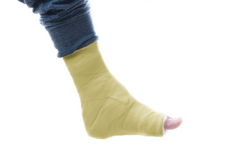 Yellow leg cast