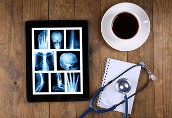 X-rays on the tablet screen and stethoscope on wooden background