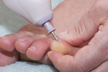 nail treatment on her feet