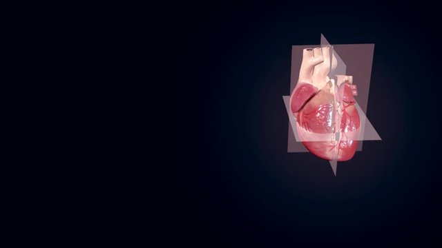 Echocardiography