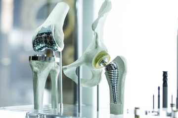 Modern knee and hip prosthesis made by cad engineer and manufactured by 3d printing - obrazy, fototapety, plakaty