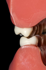 molars teeth dental occlusion