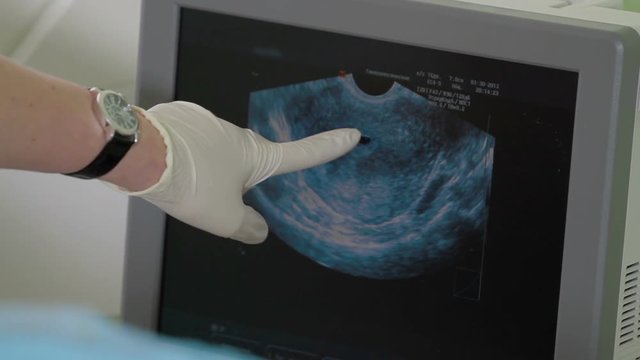 Doctor is using ultrasound machine to scan