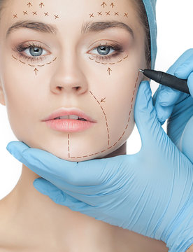 Beautiful young woman with perforation lines on her face before plastic surgery operation.
