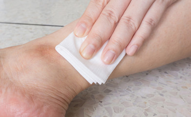 Gauze bandage on pain wound skin