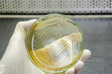 Hand in glove is holding a petri dish of cross streak of Saccharomyces cerevisiae (baker yeast)...