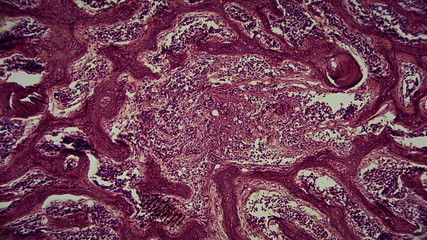 menschliche Zellen unter dem Mikroskop - Anatomie / Histologie / Pathologie
