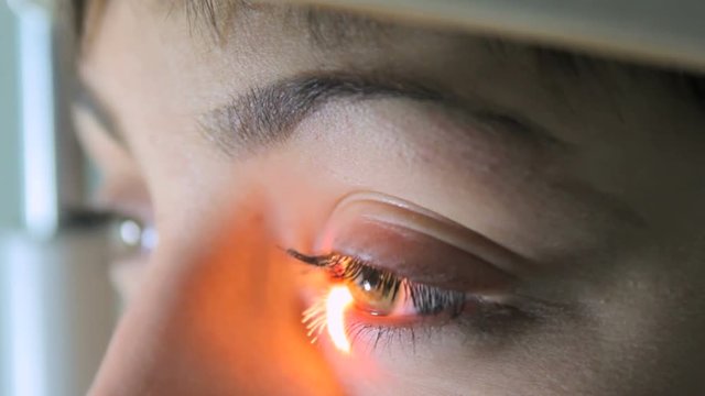 Scanning the retina among women with green eyes special ophthalmic device close-up