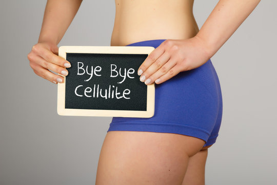 Cellulite treatment concept. Beautiful young woman in lingerie holding a small chalk board with text "Bye Bye Cellulite"