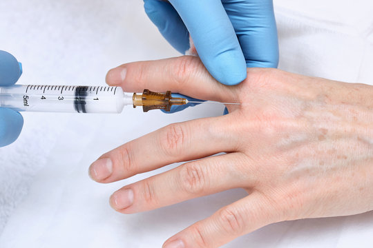 Anti aging hand injection.