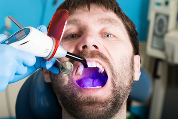 Doctor examines the oral cavity on tooth decay. Caries protection. Tooth decay treatment. Dentist...