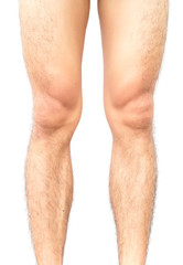 Closeup legs men skin and men hairy legs for health care concept