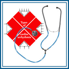 Types of cardiac arrhythmia: sinus tachycardia, sinus arrhythmia, sinus bradycardia, normal rhythm. Cardiogram. Phonendoscopes.