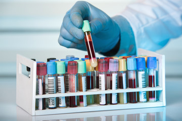 hand holding tube of rack with blood test tubes in clinical lab / hand of technician holding tube...