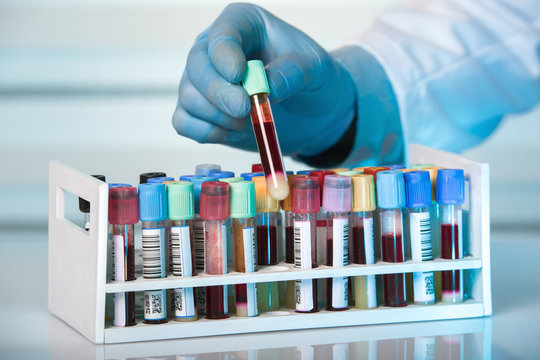 Hand Holding Tube Of Rack With Blood Test Tubes In Clinical Lab / Hand Of Technician Holding Tube Of Tray With Collection Blood Samples In The Laboratory